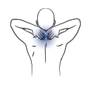 Mechanical Neck Pain